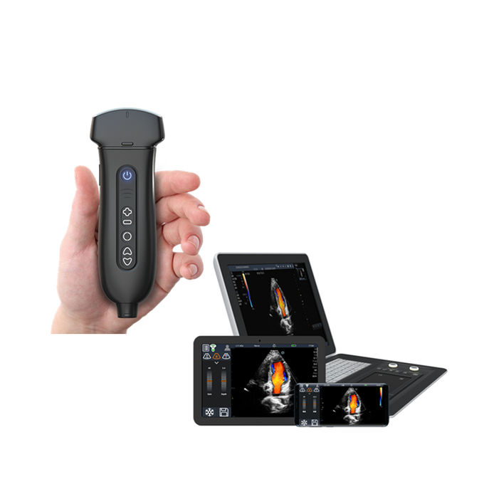 디지털 방식으로 초음파 심장 변형기 와이파이와 USB 연결을 가진 무선 색깔 초음파 조사 스캐너